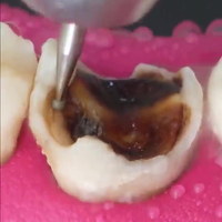 Rotte kies verbouwen