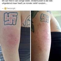 Als de ziekte van Lyme niet je grootste probleem is