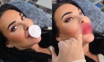 Russische dame vindt haar giga-lippen nog steeds te klein